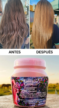 Kit Anticaída
